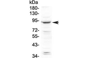 Western blot testing of human HeLa cell lysate with PLA2G6 antibody at 0. (PLA2G6 Antikörper  (AA 715-802))
