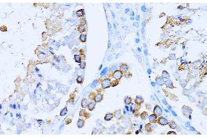 Immunohistochemistry of paraffin-embedded Mouse testis using CD63 Polyclonal Antibody at dilution of 1:100 (40x lens).