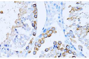 Immunohistochemistry of paraffin-embedded Mouse testis using CD63 Polyclonal Antibody at dilution of 1:100 (40x lens). (CD63 Antikörper)