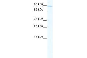Western Blot showing ZHX2 antibody used at a concentration of 1-2 ug/ml to detect its target protein. (ZHX2 Antikörper  (C-Term))