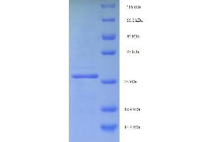 SDS-PAGE (SDS) image for C-Myc Binding Protein (MYCBP) (AA 2-103) protein (His-SUMO Tag) (ABIN4974468) (MYCBP Protein (AA 2-103) (His-SUMO Tag))