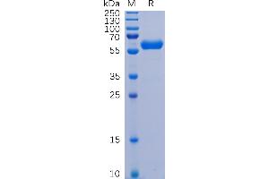 SARS-CoV-2 (2019-nCoV) S protein RBD, hFc Tag on SDS-PAGE under reducing condition. (SARS-CoV-2 Spike Protein (RBD) (Fc Tag))