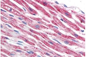 Human Heart (formalin-fixed, paraffin-embedded) stained with TUBB antibody ABIN239815 at 5 ug/ml followed by biotinylated anti-mouse IgG secondary antibody ABIN481714, alkaline phosphatase-streptavidin and chromogen.