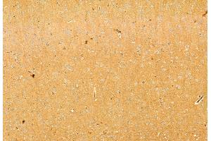 ABIN6263669 and ABIN6269346 at 1/100 staining Mouse brain tissue by IHC-P.