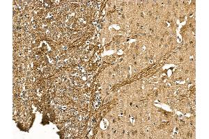 ABIN7094417 and ABIN7098464 at 1/100 staining Rat brain tissue by IHC-P.