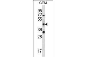 Western blot analysis in CEM cell line lysates (35ug/lane). (RBM42 Antikörper  (C-Term))