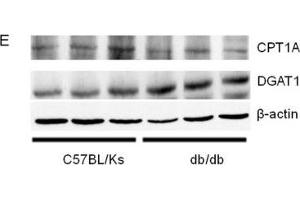 miR-30c-5p expression and triglyceride accumulation in db/db mice(A) Relative expression of miR-30c-5p among different organs. (DGAT1 Antikörper  (AA 200-300))