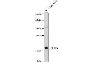 Western blot analysis of extracts of mouse pancreas, using Slc31a2 antibody (ABIN7270450) at 1:500 dilution. (SLC31A2 Antikörper  (AA 1-100))