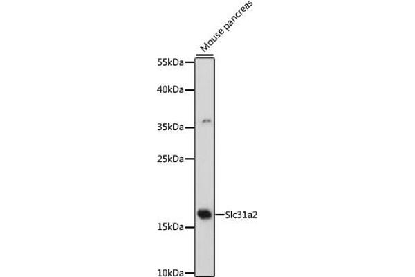 SLC31A2 Antikörper  (AA 1-100)