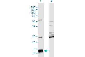 Western Blot analysis of SCGB2A2 expression in transfected 293T cell line by SCGB2A2 monoclonal antibody (M08), clone 3A4. (Mammaglobin A Antikörper  (AA 1-93))