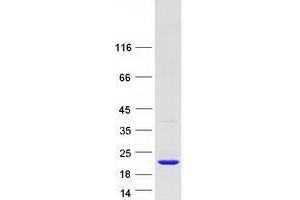 Western Blotting (WB) image for Ubiquitin-Conjugating Enzyme E2I (UBE2I) (Transcript Variant 1) protein (Myc-DYKDDDDK Tag) (ABIN2734775)