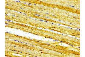 Immunohistochemistry of paraffin-embedded human skeletal muscle tissue using ABIN7146585 at dilution of 1:100