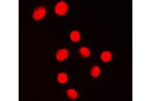 Immunofluorescent analysis of KLF1/5/7 staining in Jurkat cells. (KLF1/5/7 Antikörper  (C-Term))