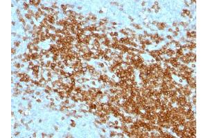 Formalin-fixed, paraffin-embedded human Tonsil stained with CD43 Mouse Monoclonal Antibody (SPN/1094). (CD43 Antikörper)
