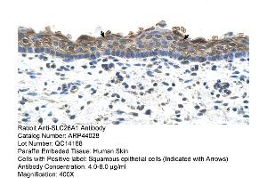 Immunohistochemistry (IHC) image for anti-Solute Carrier Family 26 (Sulfate Transporter), Member 1 (SLC26A1) (C-Term) antibody (ABIN2781680)