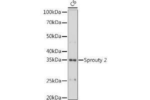 Western blot analysis of extracts of C6 cells, using Sprouty 2 antibody (ABIN7270554) at 1:1000 dilution.