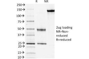 SDS-PAGE (SDS) image for anti-CD3 epsilon (CD3E) antibody (ABIN6941031)