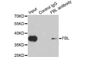 Immunoprecipitation analysis of 200ug extracts of HeLa cells using 1ug FBL antibody. (Fibrillarin Antikörper)