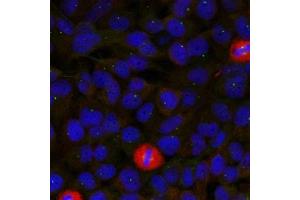 Immunofluorescence staining of methanol-fixed Hela cells using eIF4G(Ab-1232) Antibody. (EIF4G1 Antikörper)