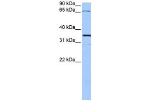 WB Suggested Anti-NLGN4X Antibody Titration:  0. (Neuroligin 4 Antikörper  (N-Term))