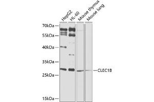 Western blot analysis of extracts of various cell lines, using CLEC1B antibody (ABIN6130012, ABIN6138705, ABIN6138706 and ABIN6225314) at 1:1000 dilution. (C-Type Lectin Domain Family 1, Member B (CLEC1B) (AA 22-196) Antikörper)