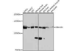 Western blot analysis of extracts of various cell lines, using Vinculin Rabbit mAb (ABIN3016604, ABIN3016605, ABIN1680530 and ABIN1680531) at 1:1000 dilution. (Vinculin Antikörper)