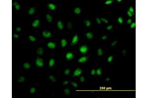 Image no. 4 for anti-CAMP Responsive Element Binding Protein 5 (CREB5) (AA 1-100) antibody (ABIN599087) (CREB5 Antikörper  (AA 1-100))