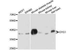 Western blot analysis of extracts of various cell lines, using GYG1 antibody. (Glycogenin 1 Antikörper  (AA 234-333))