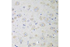 Immunohistochemistry of paraffin-embedded mouse brain using YES1 antibody at dilution of 1:100 (40x lens). (YES1 Antikörper)