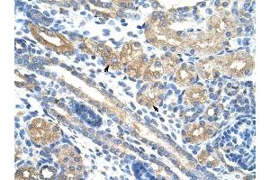 RPUSD2 antibody was used for immunohistochemistry at a concentration of 4-8 ug/ml to stain Epithelial cells of renal tubule (arrows) in Human Kidney. (RPUSD2 Antikörper  (N-Term))