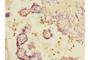Immunohistochemistry of paraffin-embedded human placenta tissue using ABIN7160270 at dilution of 1:100 (DCP1A Antikörper  (AA 303-582))