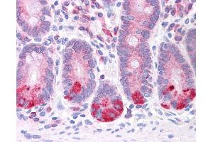 LRRC59 antibody was used for immunohistochemistry at a concentration of 4-8 ug/ml. (LRRC59 Antikörper  (N-Term))