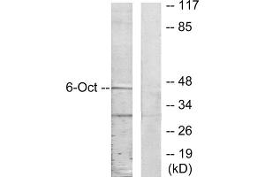 Western blot analysis of extracts from A549 cells, using OCT6 antibody. (POU3F1 Antikörper  (C-Term))