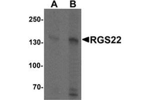 Western blot analysis of RGS22 in Jurkat cell lysate with RGS22 Antibody  at (A) 1 and (B) 2 μg/ml. (RGS22 Antikörper  (N-Term))