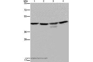 Western blot analysis of K562 and 293T cell, Jurkat cell and mouse brain tissue, using CSNK2A1 Polyclonal Antibody at dilution of 1:300 (CSNK2A1/CK II alpha Antikörper)