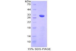 SDS-PAGE analysis of Mouse Numb Homolog Protein.