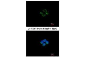 ICC/IF Image Immunofluorescence analysis of methanol-fixed A431, using ACADM, antibody at 1:200 dilution. (Medium-Chain Specific Acyl-CoA Dehydrogenase, Mitochondrial (MCAD) (Center) Antikörper)