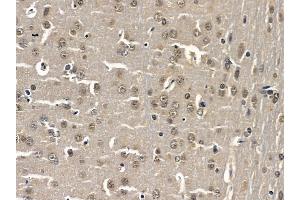 ABIN6259329 and ABIN6275330 at 1/100 staining rat brain tissue by IHC-P. (NOL10 Antikörper  (C-Term))