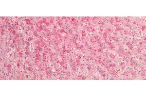 Immunohistochemistry (IHC) image for anti-Prekallikrein (PK) (AA 156-364) antibody (ABIN7434092)