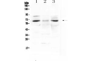 Western blot analysis of CCKBR using anti-CCKBR antibody . (CCKBR Antikörper)