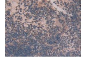 IHC-P analysis of Mouse Spleen Tissue, with DAB staining. (GLUD1 Antikörper  (AA 65-273))