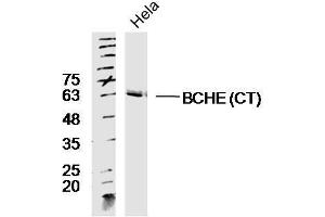 Lane 1: HeLa lysates probed with Rabbit Anti-BCHE Polyclonal Antibody, Unconjugated  at 1:300 overnight at 4˚C. (Butyrylcholinesterase Antikörper  (AA 505-602))