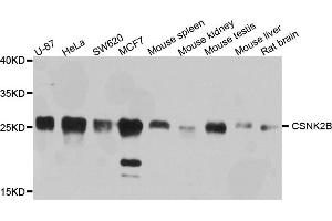 Western blot analysis of extracts of various cell lines, using CSNK2B antibody. (CSNK2B Antikörper)