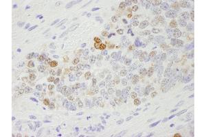 Immunohistochemistry (IHC) image for anti-Importin Subunit alpha-1 (KPNA2) (C-Term) antibody (ABIN7448767) (Importin Subunit alpha-1 (KPNA2) (C-Term) Antikörper)
