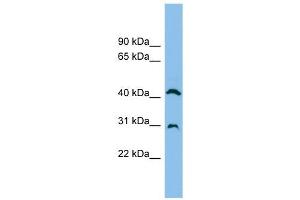 ADA antibody used at 1 ug/ml to detect target protein. (ADA Antikörper  (N-Term))