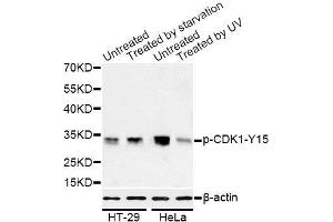 Western blot analysis of extracts of HT-29 and HeLa cells, using Phospho-CDK1-Y15 antibody (ABIN5969877) at 1/1000 dilution. (CDK1 Antikörper  (pTyr15))