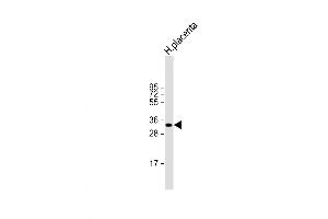 Western Blot at 1:2000 dilution + human placenta lysate Lysates/proteins at 20 ug per lane. (HPGD Antikörper  (C-Term))
