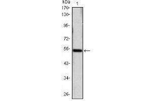 Western Blot showing SHH antibody used against SHH (AA: 26-161)-hIgGFc transfected HEK293 cell lysate. (Sonic Hedgehog Antikörper)
