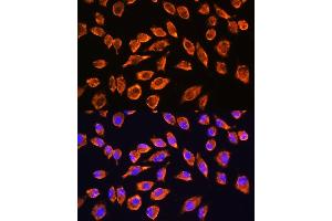 Immunofluorescence analysis of L929 cells using NMDA Rabbit pAb (ABIN1681064, ABIN3015387, ABIN3015389 and ABIN6214028) at dilution of 1:100. (NMDAR2A Antikörper  (AA 1130-1400))