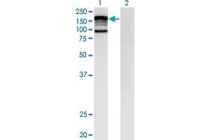 Western Blot analysis of CLIP2 expression in transfected 293T cell line by CLIP2 monoclonal antibody (M07), clone 3H5. (CLIP2 Antikörper  (AA 946-1046))